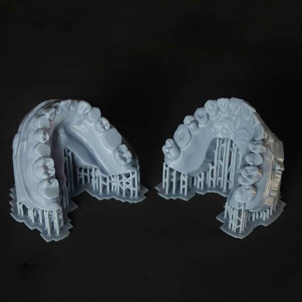 Les innovations en impression 3D dentaire avec Capdentaire