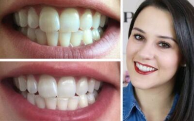 Comment avoir des dents saines toute votre vie ? Les secrets que votre dentiste ne vous dit pas assez