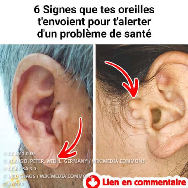 audition signes